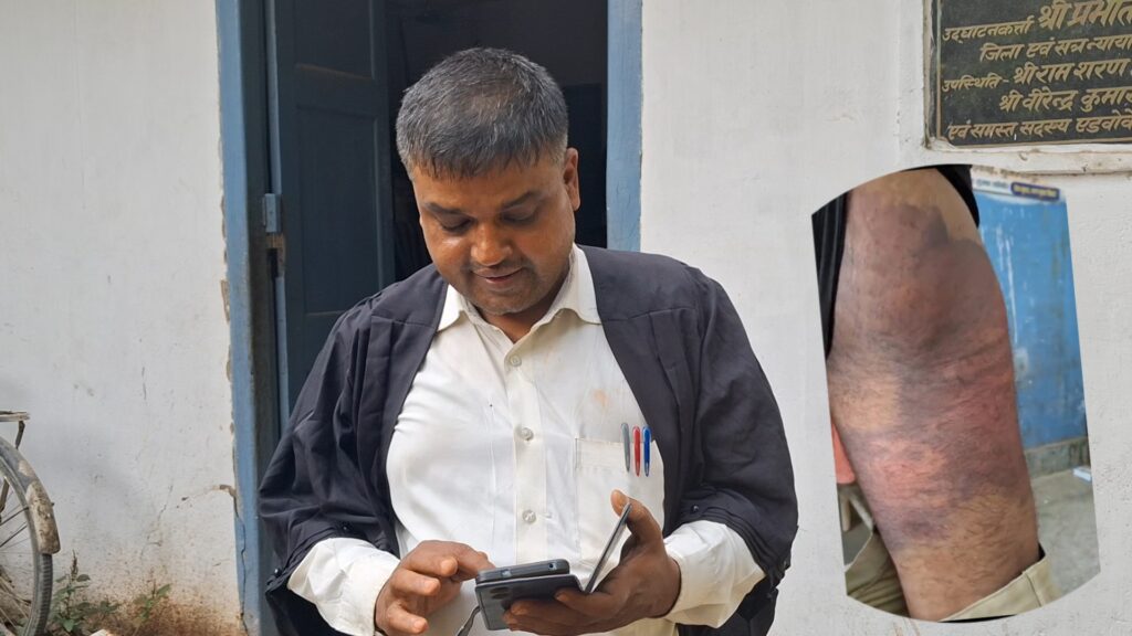 मुजफ्फरपुर: पुलिस लॉक-अप में युवक की पिटाई, मानवाधिकार आयोग ने SSP को भेजा नोटिस।